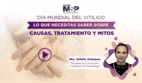 Día mundial del vitiligo: Lo que necesitas saber sobre causas, tratamiento y mitos
