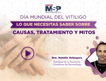 Día mundial del vitiligo: Lo que necesitas saber sobre causas, tratamiento y mitos
