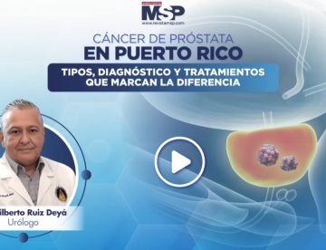 Cáncer de próstata en Puerto Rico: Tipos, diagnóstico y tratamientos que marcan la diferencia