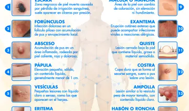 LESIONES PRIMARIAS EN LA PIEL