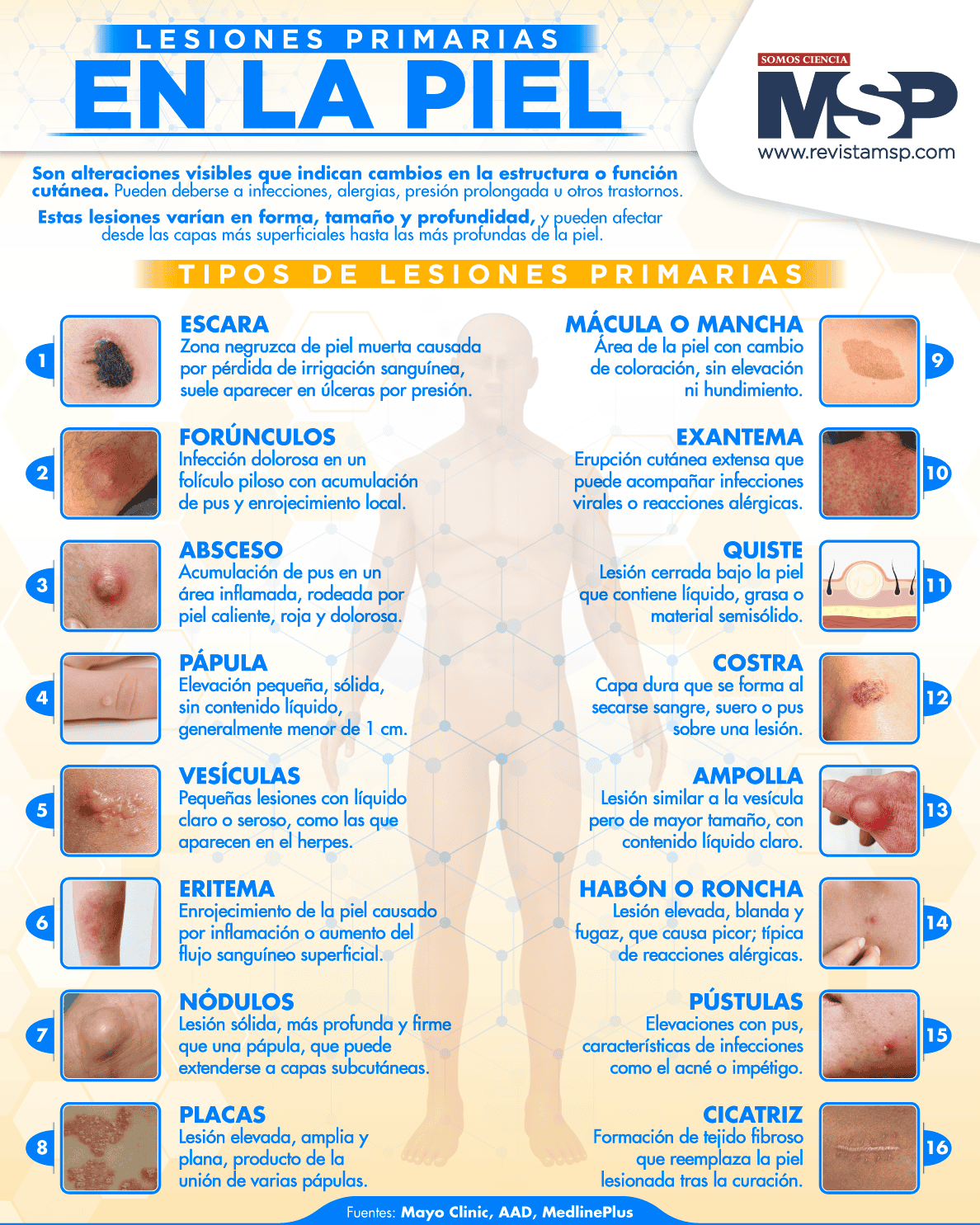 LESIONES PRIMARIAS EN LA PIEL