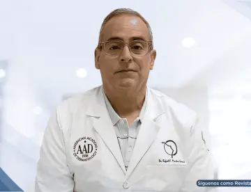 El 50 % los pacientes con urticaria crónica presenta autoanticuerpos contra el receptor de IgE