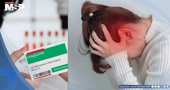 Liraglutida reduciría la frecuencia de migrañas sin depender de la pérdida de peso, según estudio