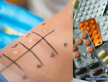 Reacciones alérgicas a medicamentos: ¿Cuáles son las más frecuentes y cómo actuar?  