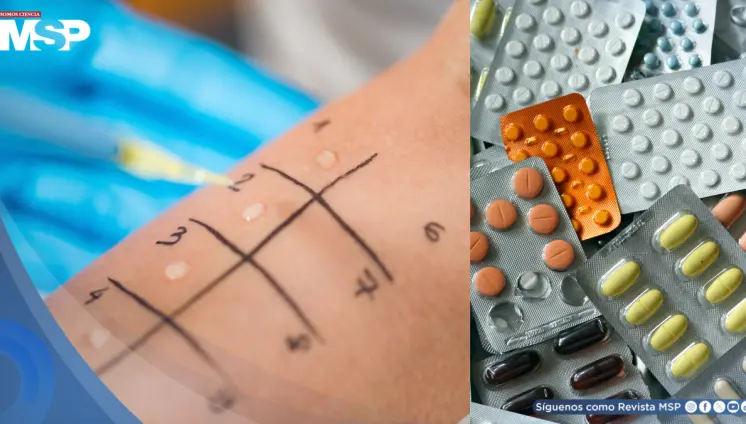 Reacciones alérgicas a medicamentos: ¿Cuáles son las más frecuentes y cómo actuar?  