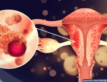 ¿Cansancio extremo durante la menstruación?: Podría ser SOP, trastorno disfórico premenstrual o anemia
