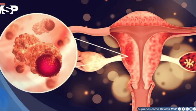 ¿Cansancio extremo durante la menstruación?: Podría ser SOP, trastorno disfórico premenstrual o anemia