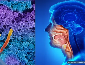 Fusobacterium nucleatum: hallan posible efecto antitumoral de una bacteria común en la boca