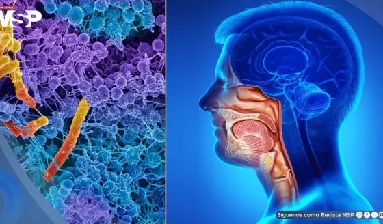 Fusobacterium nucleatum: hallan posible efecto antitumoral de una bacteria común en la boca