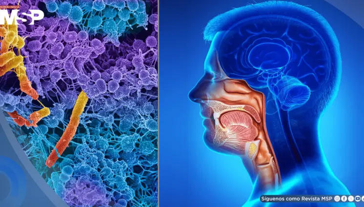 Fusobacterium nucleatum: hallan posible efecto antitumoral de una bacteria común en la boca
