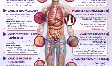 TIPOS DE V&Aacute;RICES