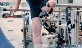 Desarrollan prótesis de rodilla biónica que se integra al hueso y al músculo para personas con amputación