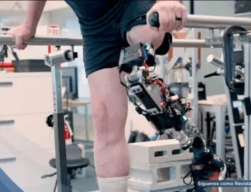Desarrollan prótesis de rodilla biónica que se integra al hueso y al músculo para personas con amputación