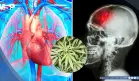 Uso habitual de marihuana se asociaría con mayor riesgo de eventos cardiovasculares y cerebrovasculares