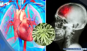 Uso habitual de marihuana se asociaría con mayor riesgo de eventos cardiovasculares y cerebrovasculares
