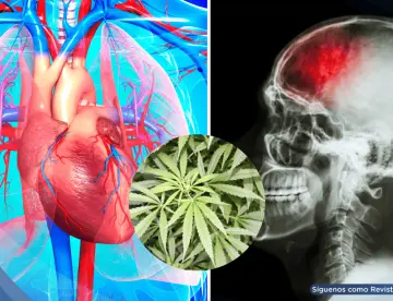Uso habitual de marihuana se asociaría con mayor riesgo de eventos cardiovasculares y cerebrovasculares