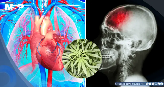 Uso habitual de marihuana se asociaría con mayor riesgo de eventos cardiovasculares y cerebrovasculares