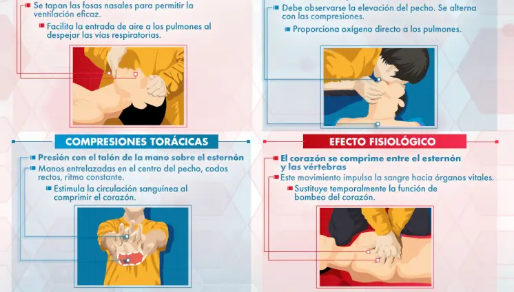 REANIMACIÓN CARDIOPULMONAR EXTERNA