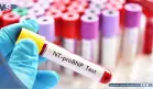 NT-proBNP podría ayudar a predecir riesgo de un nuevo evento cardiovascular tras un infarto