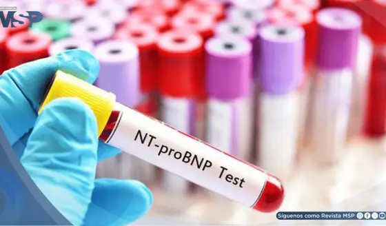NT-proBNP podría ayudar a predecir riesgo de un nuevo evento cardiovascular tras un infarto