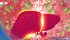 Hepatitis C: la infección silenciosa que puede dañar el hígado por décadas sin dar señales