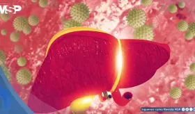 Hepatitis C: la infección silenciosa que puede dañar el hígado por décadas sin dar señales