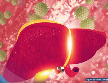 Hepatitis C: la infección silenciosa que puede dañar el hígado por décadas sin dar señales