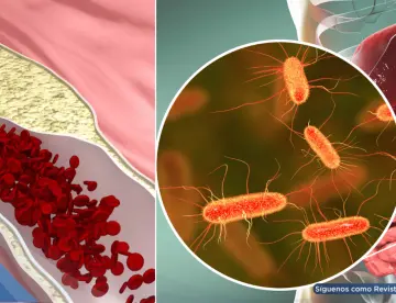 Identifican molécula producida por bacterias intestinales que podría obstruir las arterias