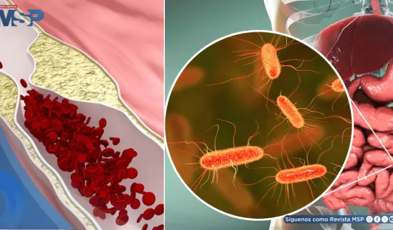 Identifican molécula producida por bacterias intestinales que podría obstruir las arterias