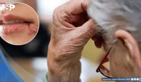 Los herpesvirus podrían acelerar el alzhéimer y la esclerosis múltiple, según investigadores