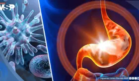 Gastroenteritis: ¿Cómo prevenir la infección que causa diarrea y vómitos?