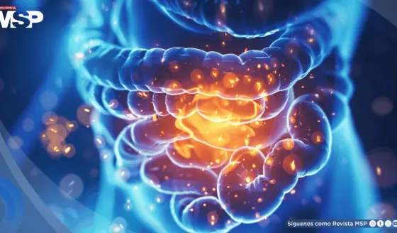 Alarma médica: Aumentan los cánceres gastrointestinales en adultos menores de 50 años