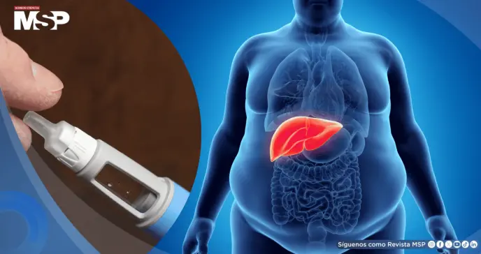 Fármaco contra la diabetes y obesidad muestra beneficios potenciales en hígado graso 