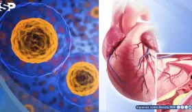 Descubren cómo revertir la acumulación de colesterol en las arterias restaurando la función de células vasculares