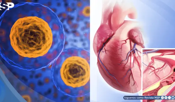 Descubren cómo revertir la acumulación de colesterol en las arterias restaurando la función de células vasculares