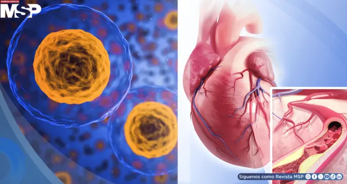 Descubren cómo revertir la acumulación de colesterol en las arterias restaurando la función de células vasculares