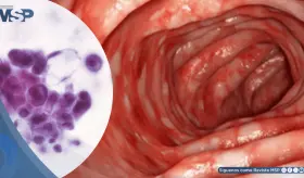 Científicos descubren que la proteína STING desencadena la inflamación en la colitis ulcerosa