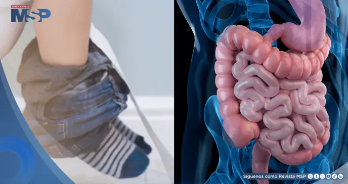 Encopresis: claves para identificar un trastorno del control intestinal en niños. Todo lo que debes saber