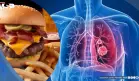 Consumo elevado de ultraprocesados se asocia con mayor riesgo de cáncer de pulmón, según estudio