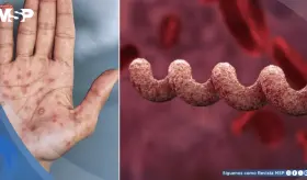 ¿Qué es la sífilis y cómo puedes detectarla?