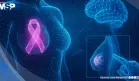 Nuevo modelo de inteligencia artificial detecta cáncer de mama con 90% de precisión