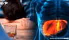 Científicos alertan sobre obesidad, alcohol y hepatitis como principales causas del cáncer de hígado