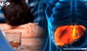 Científicos alertan sobre obesidad, alcohol y hepatitis como principales causas del cáncer de hígado