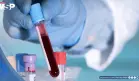 Un análisis de sangre podría detectar el cáncer en etapa temprana con 78% de precisión
