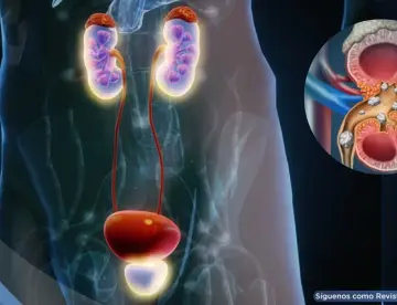 ¿Urgencia repentina de orinar? Conoce los tipos de incontinencia urinaria, síntomas y cómo tratarlos
