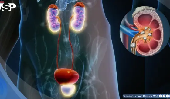 &iquest;Urgencia repentina de orinar? Conoce los tipos de incontinencia urinaria, s&iacute;ntomas y c&oacute;mo tratarlos
