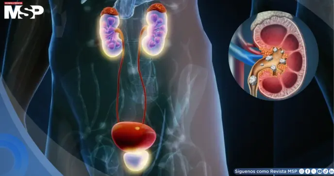 ¿Urgencia repentina de orinar? Conoce los tipos de incontinencia urinaria, síntomas y cómo tratarlos