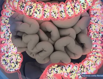 Alteraciones en la microbiota aumentan el riesgo de cáncer colorrectal en personas con obesidad, estudio