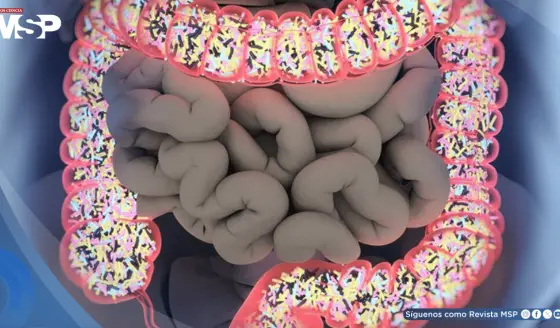 Alteraciones en la microbiota aumentan el riesgo de cáncer colorrectal en personas con obesidad, estudio