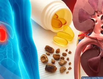¿Estás consumiendo demasiada vitamina D?  Esto es lo que debes saber sobre sus efectos en los riñones